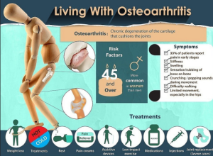 trattamento naturale di osteoartrite