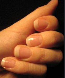 how to get healthy nails